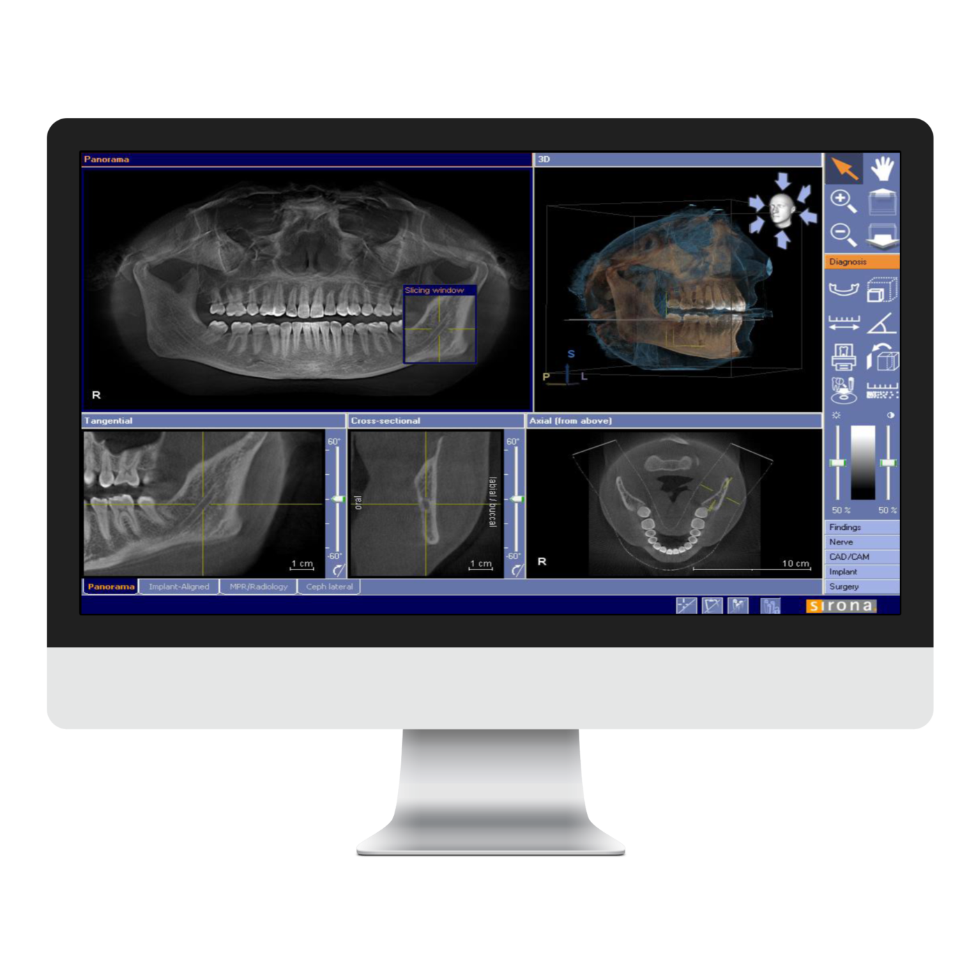 Digital scan shown on monitor at The Hub Dental Practice
